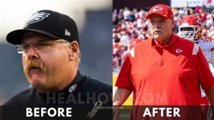 Andy Reid Weight Loss: Discover How He Shed Pounds and Get a Healthy Life 