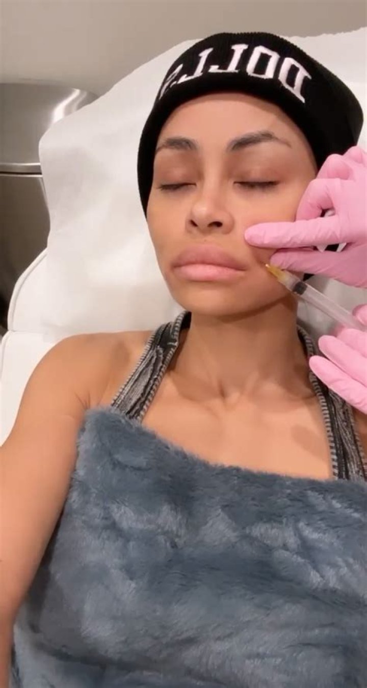 
Blac Chyna Undergoes Breast and Butt Reduction Surgeries, Shares Update on Instagram 
