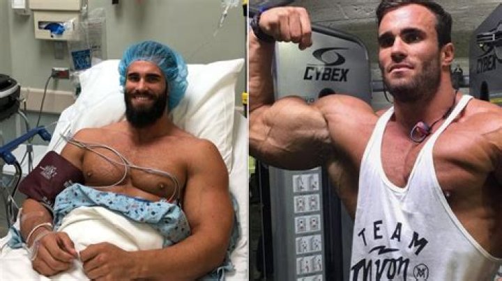 Bodybuilder Calum Von Moger in hospital pictures