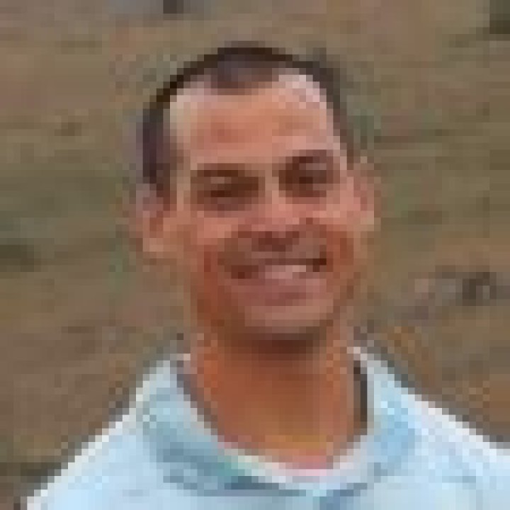 Dr. Brent Izu, MD – Antioch, CA