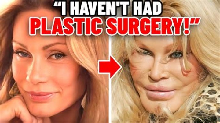 
Catwoman Plastic Surgery What Are The Risks And What To Consider! 