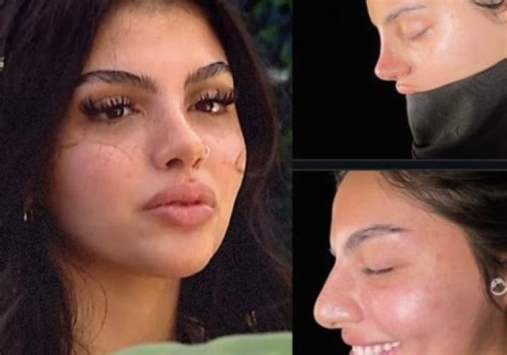 
Coco Lodge Love Island Before Surgery And Nose Job Pictures, Is She Transgender? 