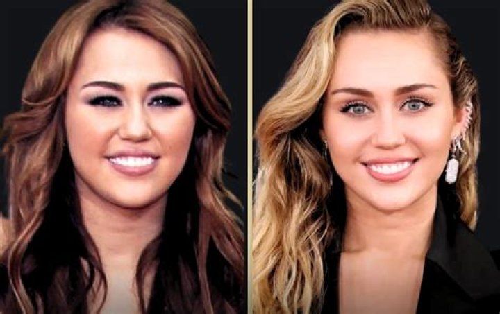 
Did Erin Darke Get Her Nose Done? Before And After Photos 