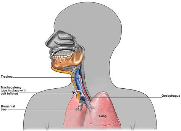 
Did Jean Claude Van Damme Have Tracheostomy For Throat Cancer? What Happened? 