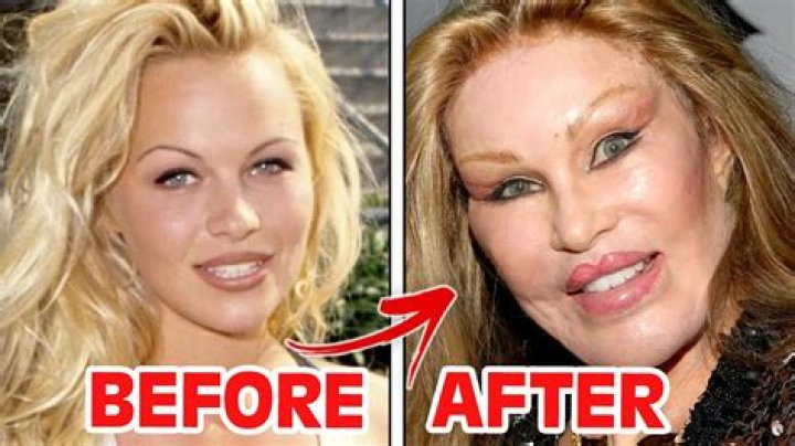 Did Mila Kunis Had Plastic Surgery On Cheetos Commercial? Before And After