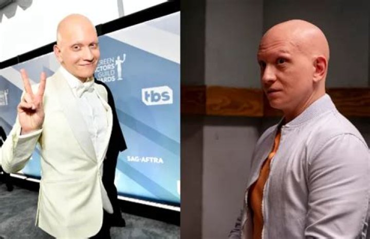 Does Anthony Carrigan Have Cancer? Bald Hair Cause And Health Condition Update