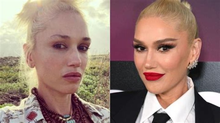 
Gwen Stefani With No Makeup Look: Did She Have A Face Surgery? 