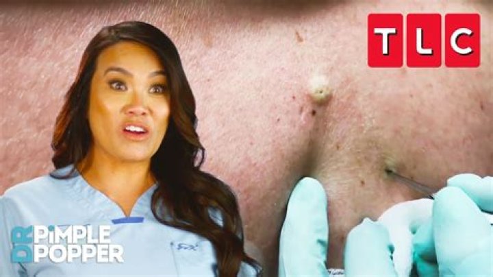 How much is Dr. Pimple Popper's net worth? Salary, cost per session