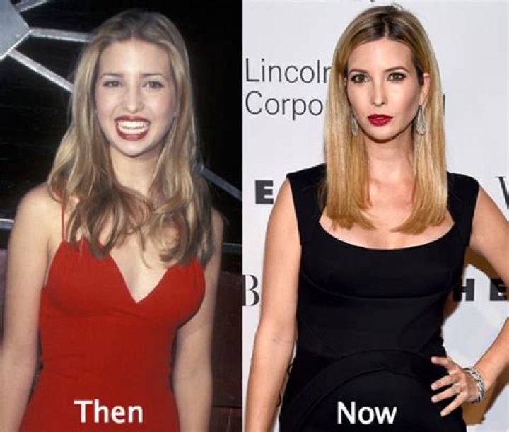Ivanka Trump Plastic Surgery: A Deep Dive Into Celebrity Transformations