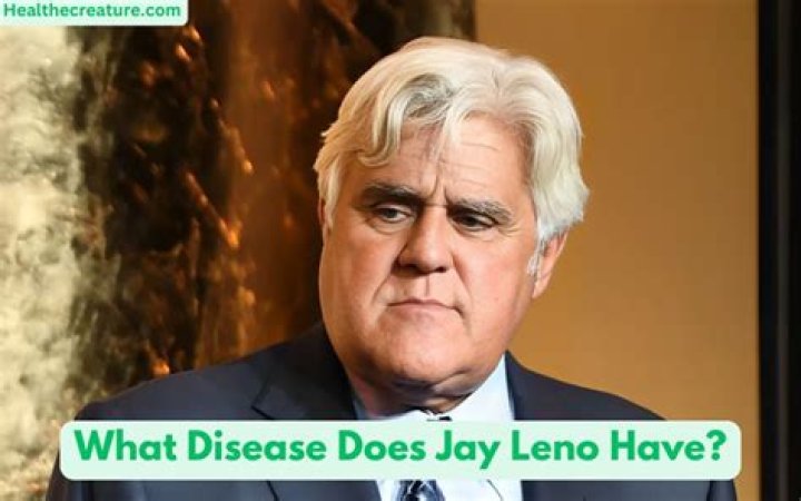 Jay Leno health: What disease does Jay Leno have?