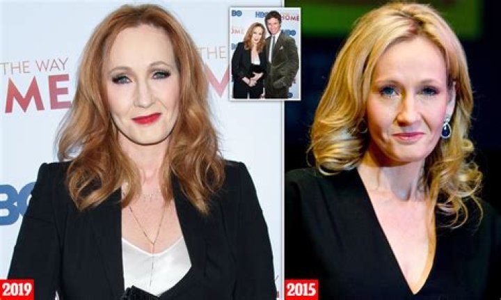 JK Rowling Facelift Plastic Surgery Before and After