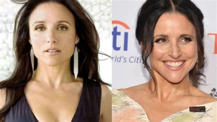 Julia Louis-Dreyfus Nose Job Plastic Surgery Before and After