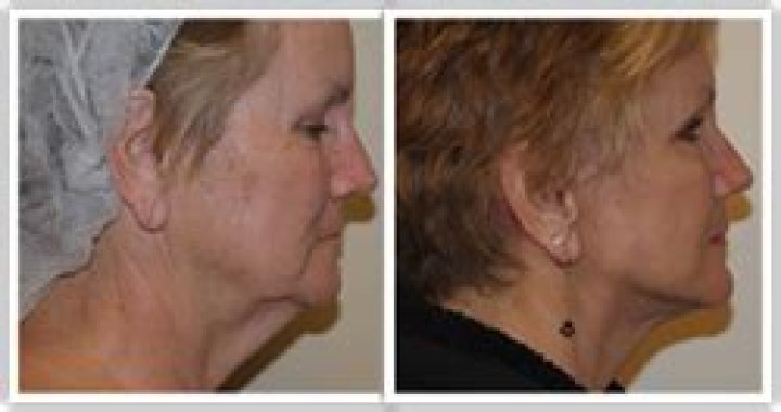 Dr. K. Cary Canoun, MD – Walnut Creek, CA