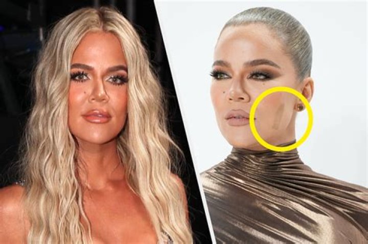 
Khloé Kardashian Had a Tumor Removed from Her Face: ‘So Grateful We Caught This Early’ 