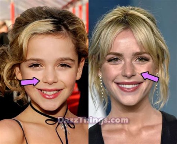 Kiernan Shipka Plastic Surgery: Her New Look Sparks Plastic Surgery Speculation