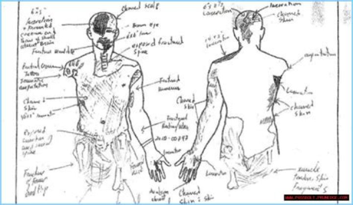 Kobe Bryant and Gidi Bryant Autopsy Pictures Sketches Leak Online