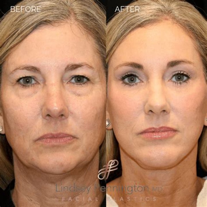 Dr. Lindsey Nondorf, MD – Greenwood, IN