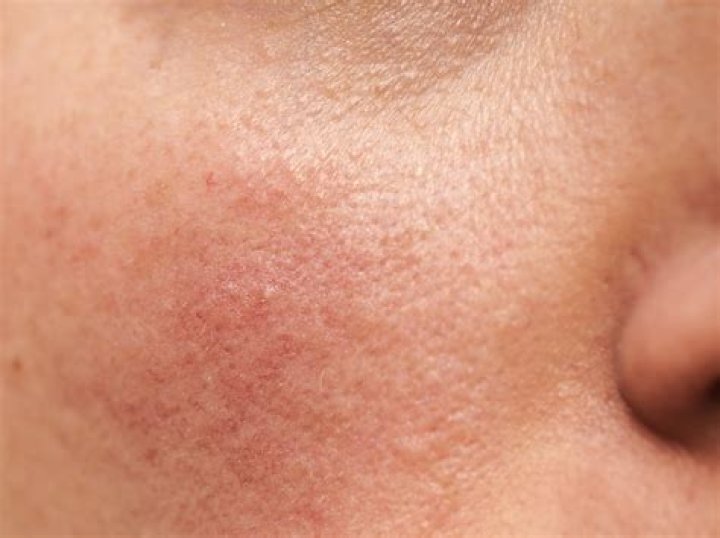 Dr. Matthew Hoffmann, MD – Longview, TX