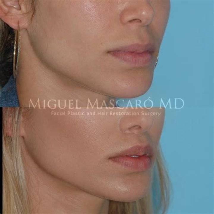 Dr. Miguel Mascaro, MD – Birmingham, AL