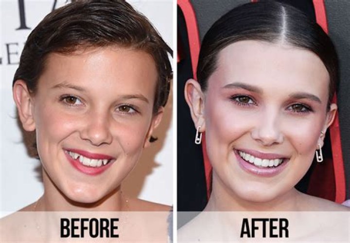 Millie Bobby Brown has changed beyond recognition