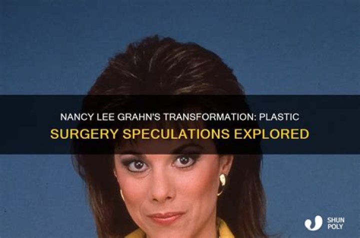 
Nancy Lee Grahn Surgery Update- Turns Out She Is Not Leaving General Hospital!! 
