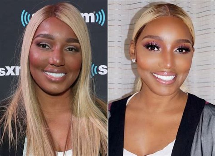 NeNe Leakes Mocked After Posting Pic That Looks Like A Photoshop Fail Or Like She Had Too Much Plastic Surgery!