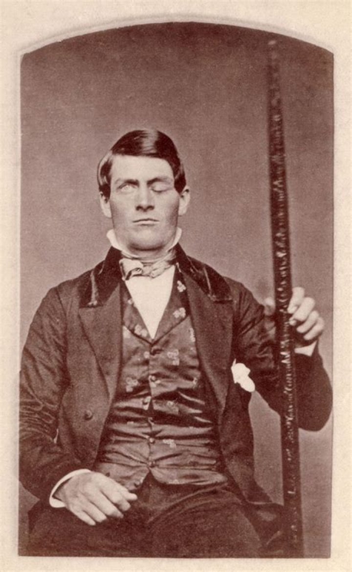 Phineas Gage Biography - Facts, Childhood, Family Life & Achievements