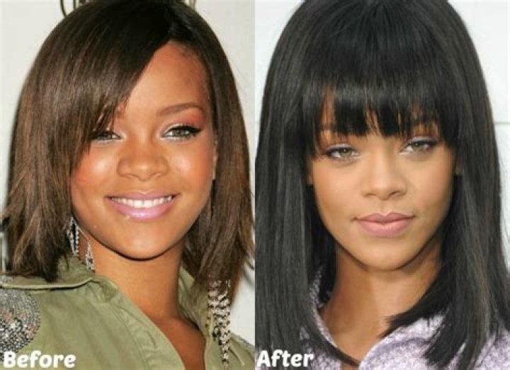 Rihanna Nose Job Plastic Surgery Before and After