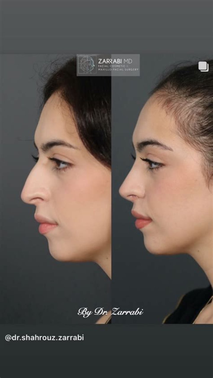 Dr. Shahrouz Zarrabi, MD – New Orleans, LA