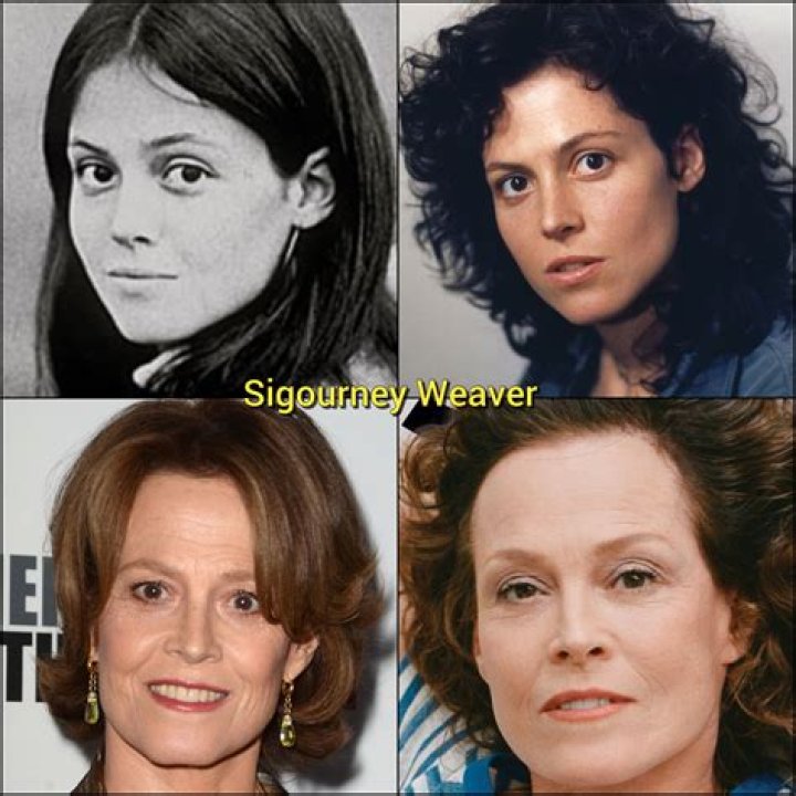 Sigourney Weaver Plastic Surgery Before and After