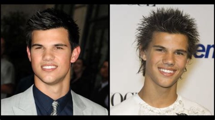 Taylor Lautner Plastic Surgery Before and After
