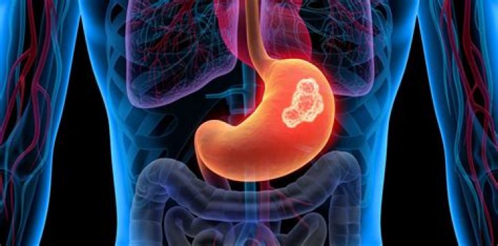 What disease does Toby Keith have? Stomach cancer revealed