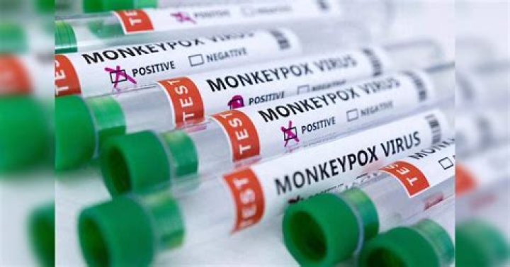 
US reports nearly 24,000 monkeypox cases 