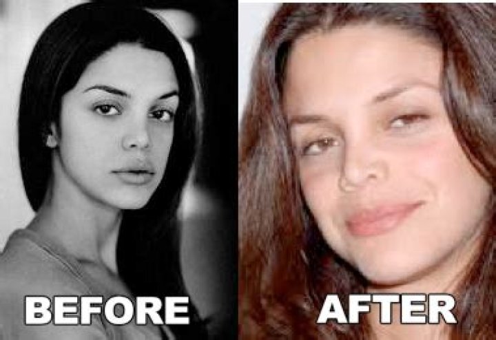 Vanessa Ferlito Plastic Surgery Before and After