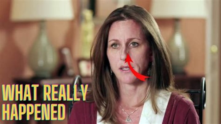 What happened to Kim Gravel’s face?