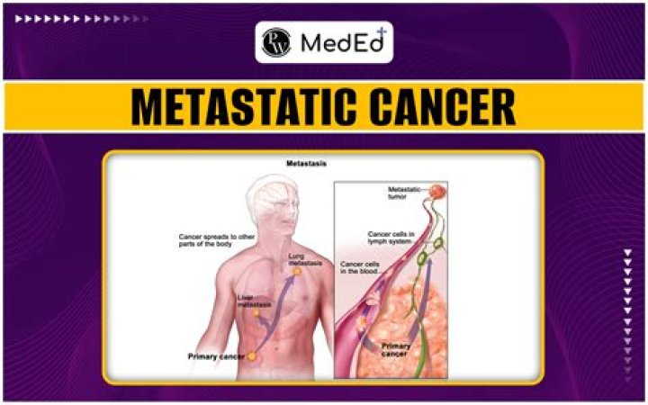 
What is metastatic adenocarcinoma? Tom Jackson cause of death explored as Queer Eye star dies aged 63 