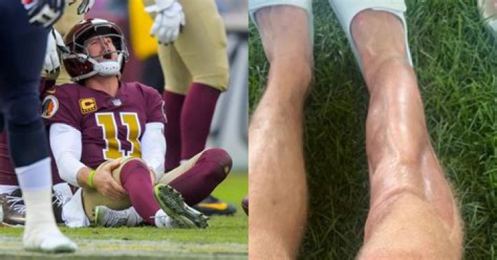 
What Is Wrong With Alex Smith Leg? Injury And Health Update On American Football Quarterback 